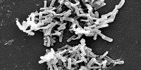 FDA to Regulate Fecal Transplants image: FDA to Regulate Fecal Transplants