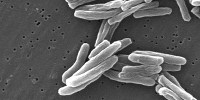 image: Vitamin C Slays TB Bacteria