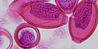 image: Image of the Day: Parasite Eggs