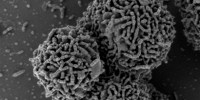 image: Arctic Bacteria Thrives at Mars Temps