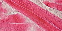 image: Muscle Disease Gene Identified in Fish