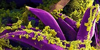 image: Image of the Day: Bubonic Plague