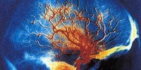 image: Opinion: BRAIN Is Not Enough