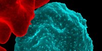 image: Image of the Day: Lumpy Cell