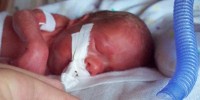 image: Leaders of Infant Trial Will Not Yet Face Sanctions