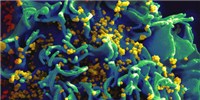 image: Image of the Day: HIV