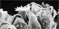 image: Image of the Day: Ragweed Pollen