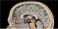 Opinion: The Present and Future of Neurogenomics image: Opinion: The Present and Future of Neurogenomics