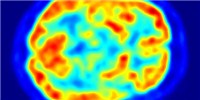 image: Opinion: Toxicants and the Brain
