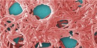 image: Image of the Day: Legionnaire Bug