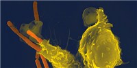 Image of the Day: Anthrax Killer image: Image of the Day: Anthrax Killer