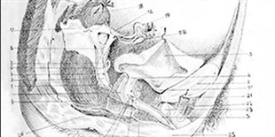 A Case of Sexual Ambiguity, 1865