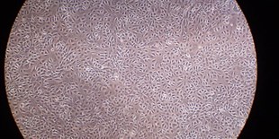 LabQuiz: The Transfection Talk