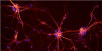 With CRISPR, Scientists Make Neurons From Fibroblasts