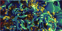 HIV Spread from Haiti to NYC in 1970, “Patient Zero” Not to Blame