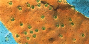 Nuclear Pores Come into Sharper Focus