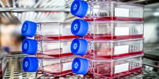 LabQuiz: How Well do you Know Your Culture Media?