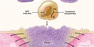 Starvation Response Triggers Melanoma Invasion