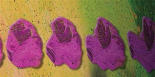 Scientists Successfully Transplant Human Leukemia Cells into Mice