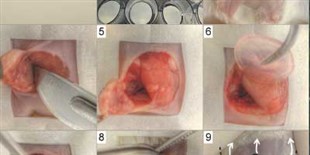Gel Scaffolds for Delivery of Immunotherapies