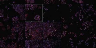 Picking Out Patterns