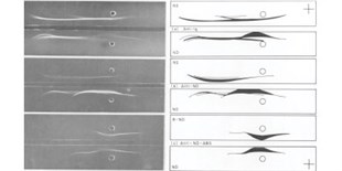 Self-Experimentation Led to the Discovery of IgE