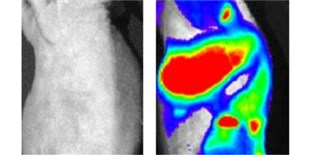 Transgenic Mouse Illuminates Melanoma Metastasis