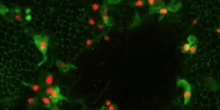 Image of the Day: Oculus Reparo