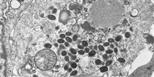 Smallpox Kerfuffle Reveals Biosecurity Problems