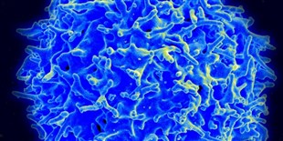 FDA Votes Yes on CAR T-Cell Therapy