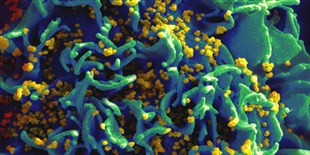 Child Lives with HIV for Years Without Treatments