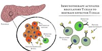 image: Immunotherapy Promising for Diabetes: Study