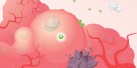 image: Where Cancer and Inflammation Intersect