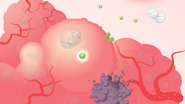 Where Cancer and Inflammation Intersect image: Where Cancer and Inflammation Intersect
