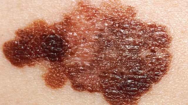 Imagining a Cure image: Imagining a Cure