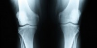 image: A Joint Endeavor