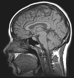 Monkey mind control image: Monkey mind control