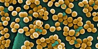 image: Google, epidemiology tool