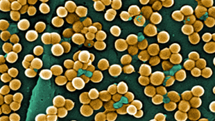 Google, epidemiology tool image: Google, epidemiology tool