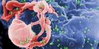 image: Opinion: Progress toward an HIV/AIDS vaccine