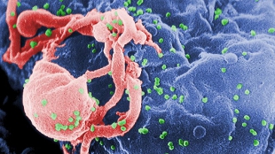 Opinion: Progress toward an HIV/AIDS vaccine image: Opinion: Progress toward an HIV/AIDS vaccine