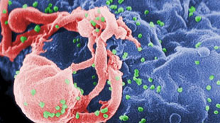 Vaccine primes T-cells for SIV image: Vaccine primes T-cells for SIV