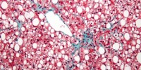 image: Stem cells may mend liver damage