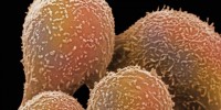 image: Basophil Roles