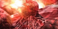 image: An Aspirin for your Cancer?