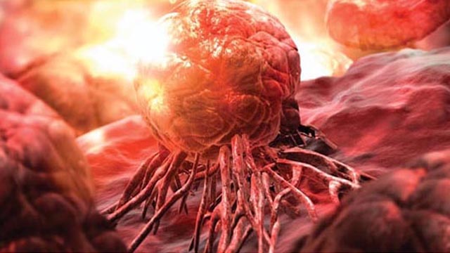 An Aspirin for your Cancer? image: An Aspirin for your Cancer?