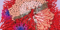 image: Model Liver