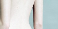 image: Taking Aim at Melanoma