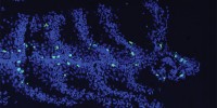 image: Thymus Finder
