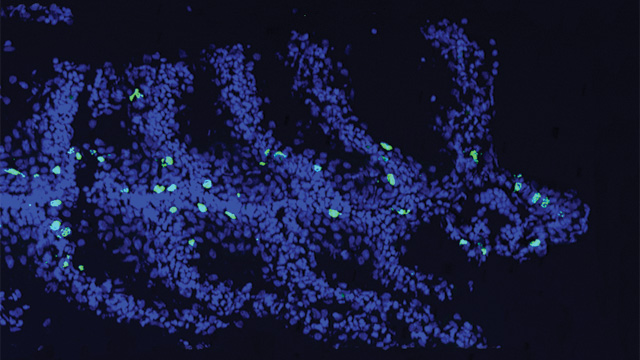 Thymus Finder image: Thymus Finder